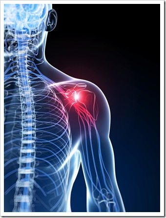 Shoulder Pain Jackson MS Rotator Cuff Syndrome